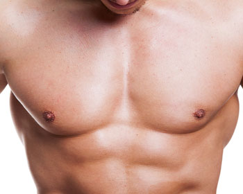 Gynecomastia Surgery